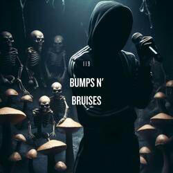Bumps n' Bruises