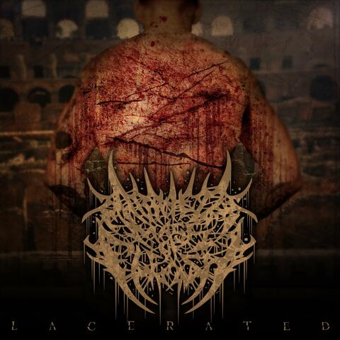 Lacerated