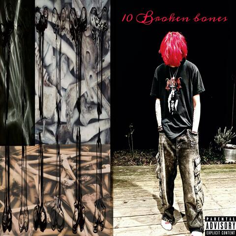 10 Broken Bones