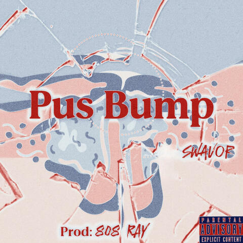 Pus Bump