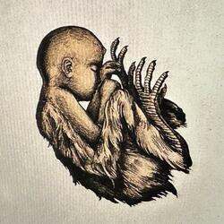 Acephaly