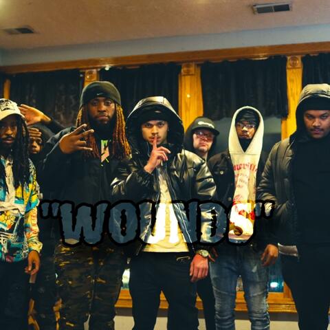 Wounds