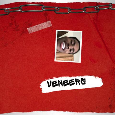 Veneers