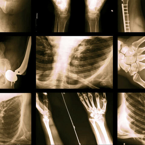Injury