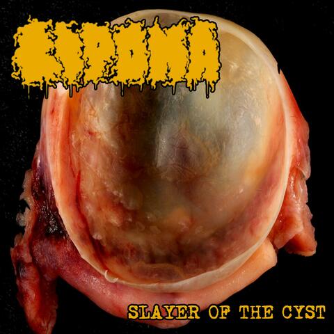 Slayer of the Cyst
