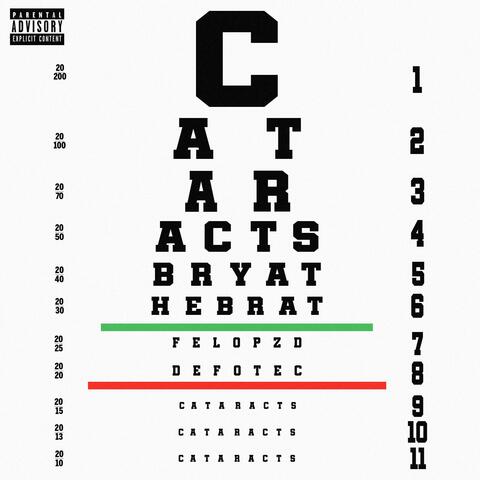 Cataracts
