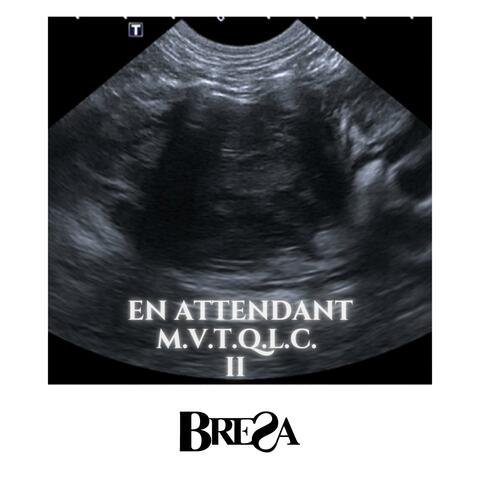 EN ATTENDANT MVT_QLC II