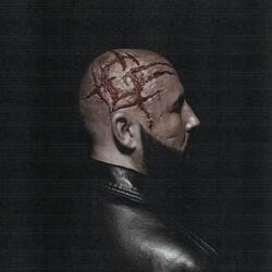 fvcked up intermezzo