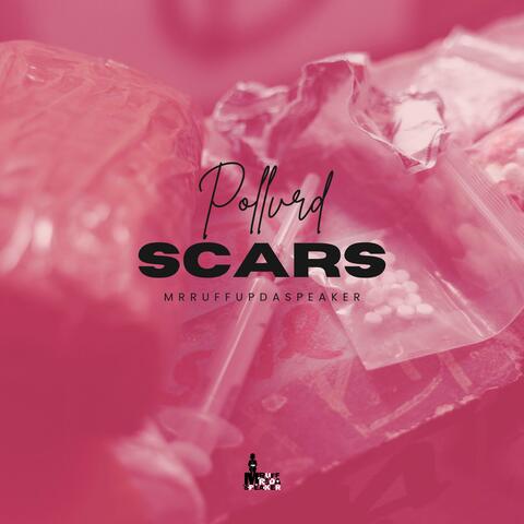 Scars