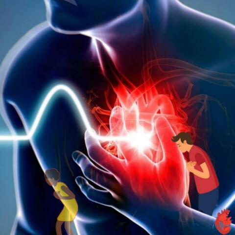 Heart Attack