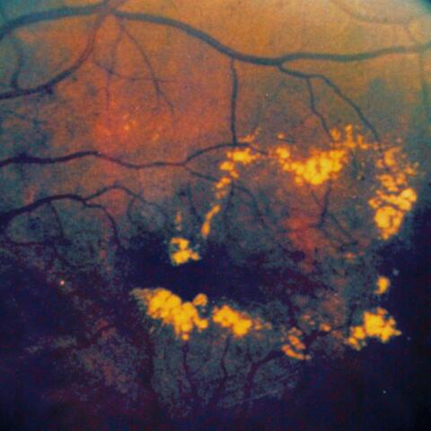 Light Leaks