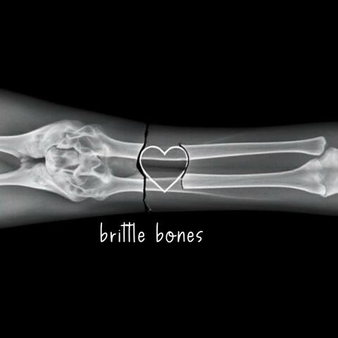 brittle bones