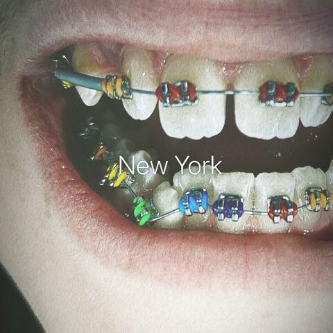 BraceFace
