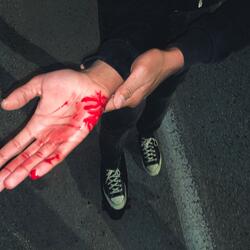 NO BRUISES, BAD SUMMER