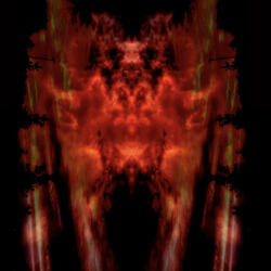 Phlebotomized