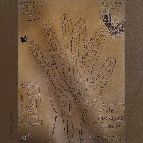 Polymetacarpal