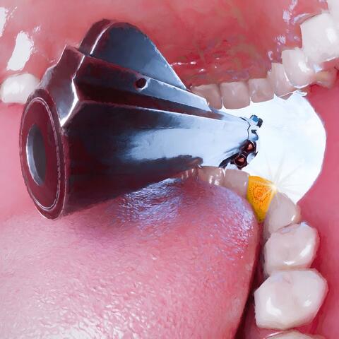 le blanc de ma peine (feat. LOOK FOR AMI)