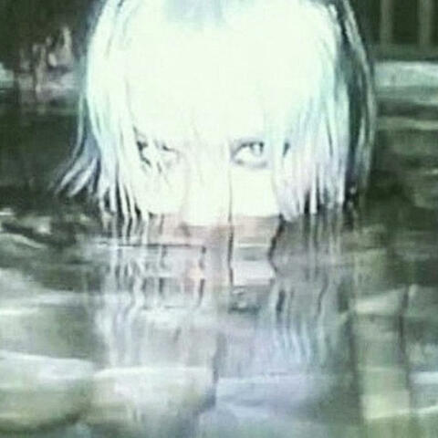 X Vision