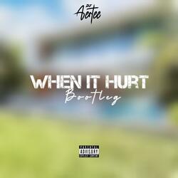 When it hurt_(bootleg)