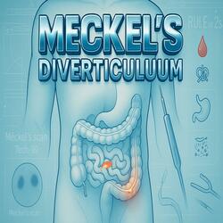Meckel’s Diverticulum 1