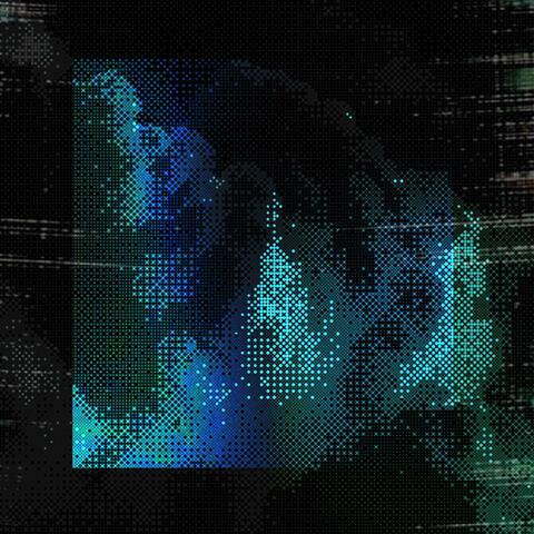 Everything hurts, does it even matter?