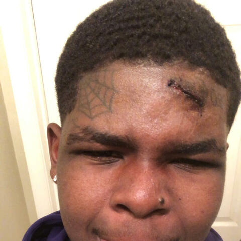 COVERING MY SCARS