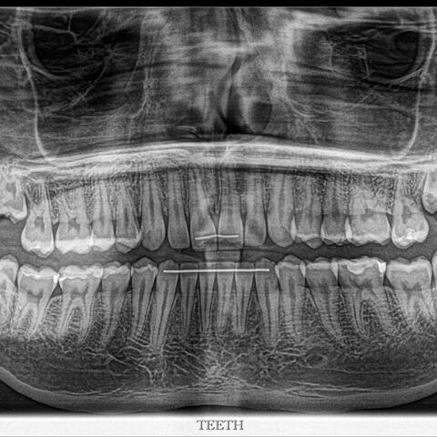 Teeth