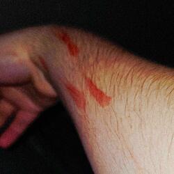 Suffer from a Lover