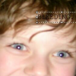 BLEEDING