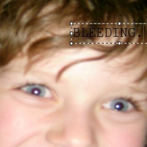 BLEEDING