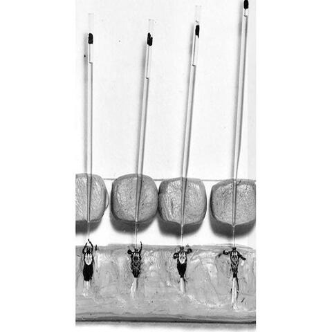 Anomalous Health Incidents