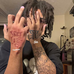Suicide