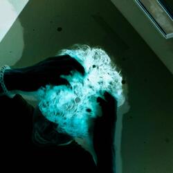 dandruff
