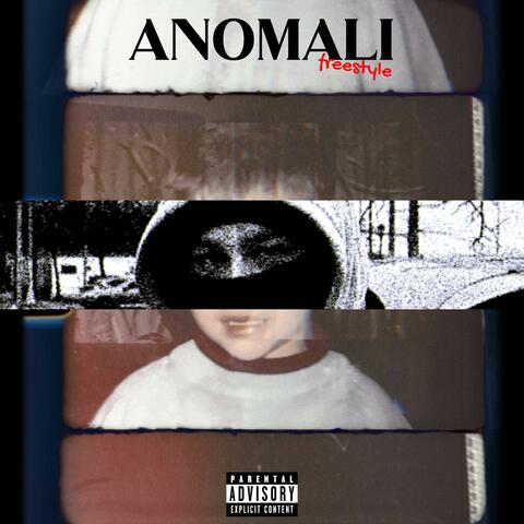 anomali freestyle