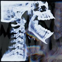 NSFW (WEEDLEGEND MIX)