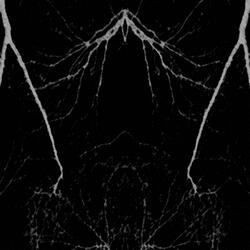 The Mountain Has Fallen (Remixed)