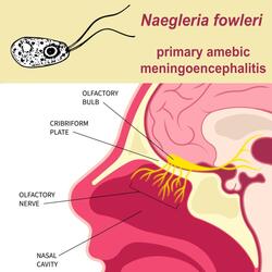 Naegleria fowleri Survivors (Glam Version)