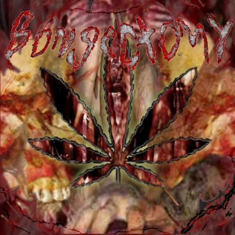 Cannibinoid Hyperemesis Fatality