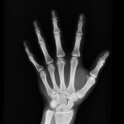 Bare Bones