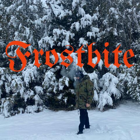 FROSTBITE