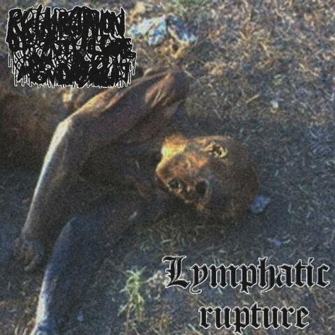 Tracks Off Split Tape w/ Lymphatic Rupture