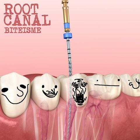 Root Canal