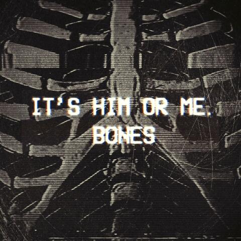 Bones
