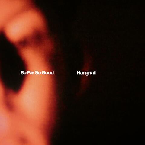 Hangnail