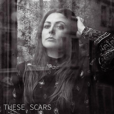 These Scars