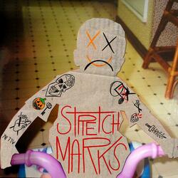 Stretch Marks