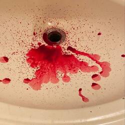 lil nosebleed (feat. Vxmpire)