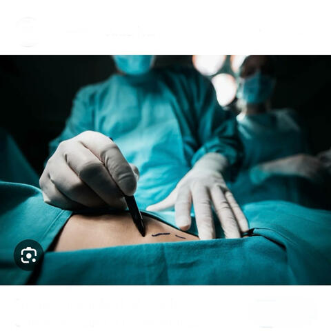 Surgery (feat. T-Guapo)