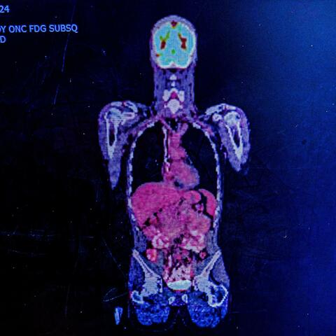 Bound 2 Be Worm Food