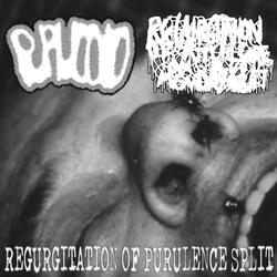 Removal of a Festering Tumor Using A Dull Axe In A Hacking Motion